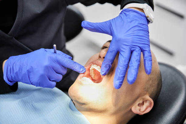 Best Knocked-Out Tooth (Avulsed Tooth) Treatment in Manvel, TX